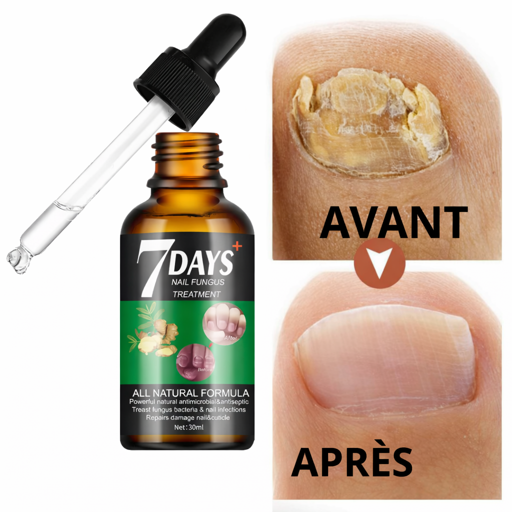 Sérum Antifongique pour Ongle